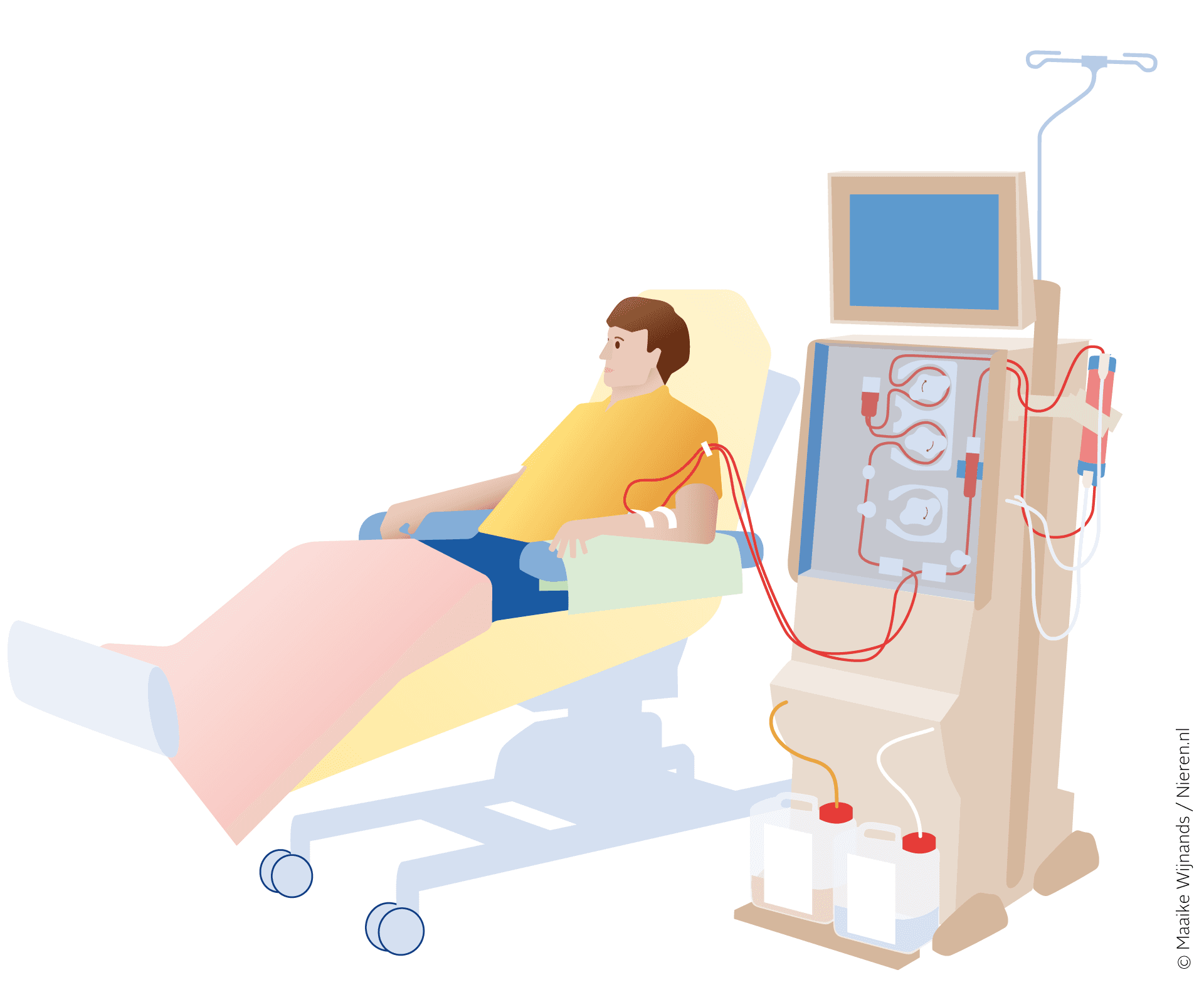 Illustratie van patiënt die is aangesloten op de dialysemachine