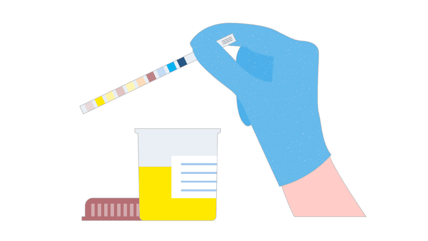 urinetest illustratie